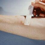 Tuberculosis Testing for Work, School, and Peace of Mind